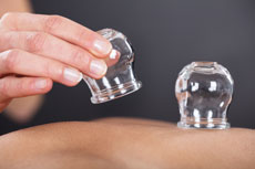 Cupping sessions now available at the George Wellbeing Center